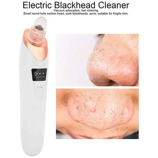Blackhead Remover